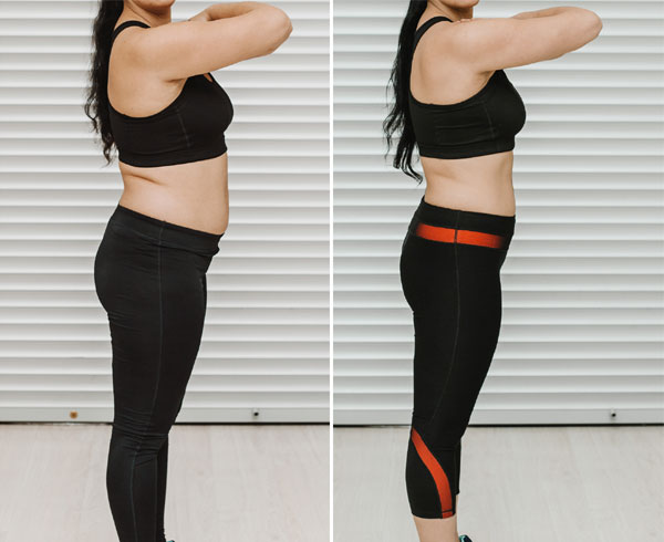 Body Contouring / Body Sculpting